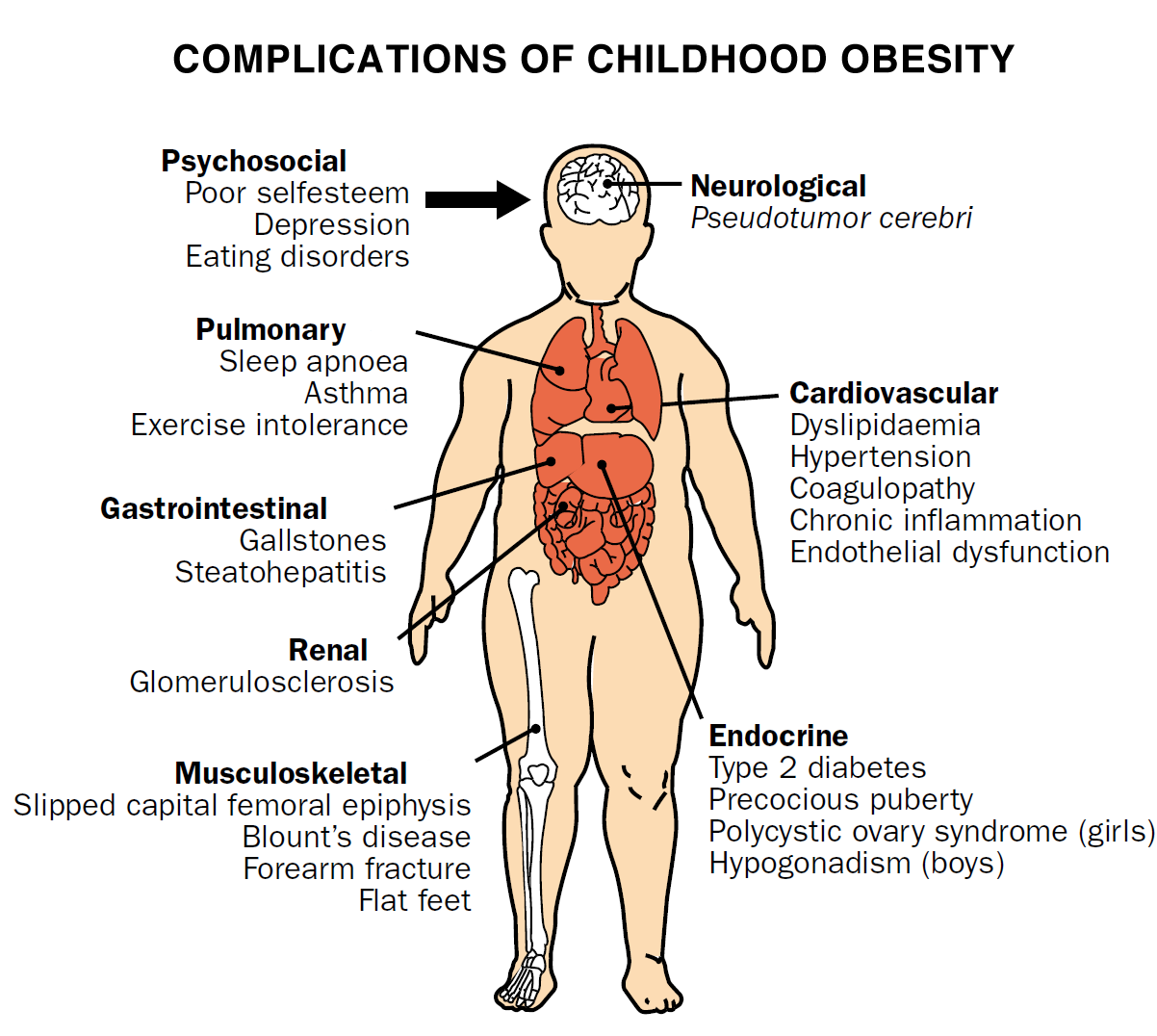 Diabetic Kids' New Regimen