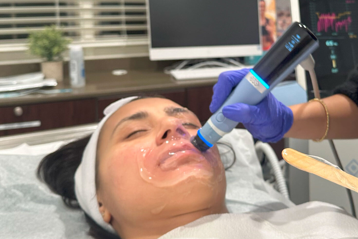 A Heal n Cure provider uses the Exion handpiece to administer a patient's treatment, similar to RF microneedling in Glenview.